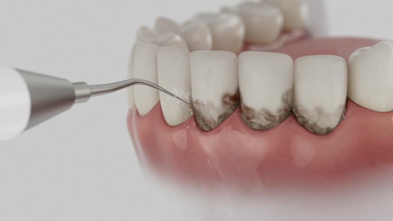 Trusted Dental Implants service in Fremont, NC - Dentist Open Now